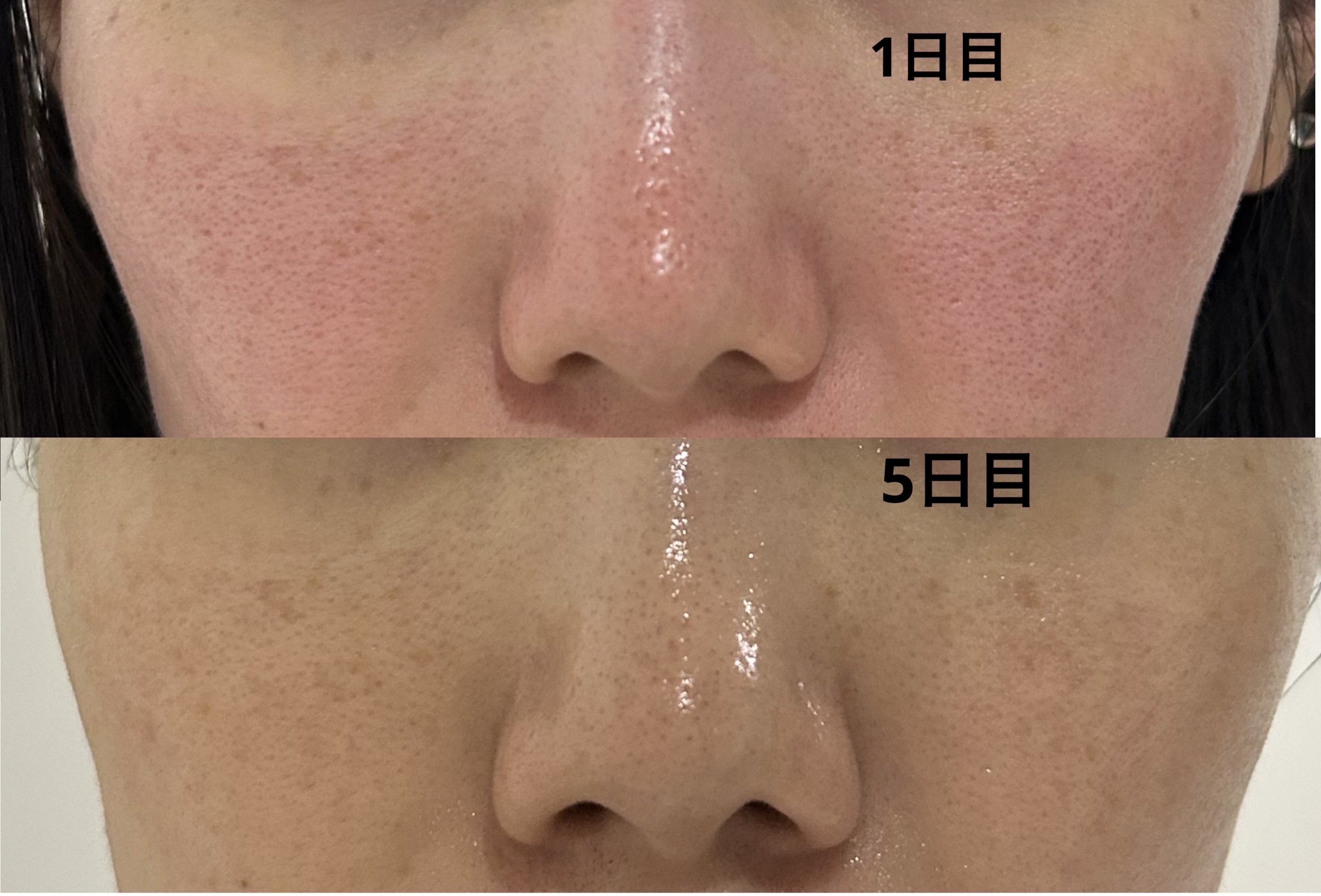 試してみた】ボタニカルピール ピーリングパウダー Lv7