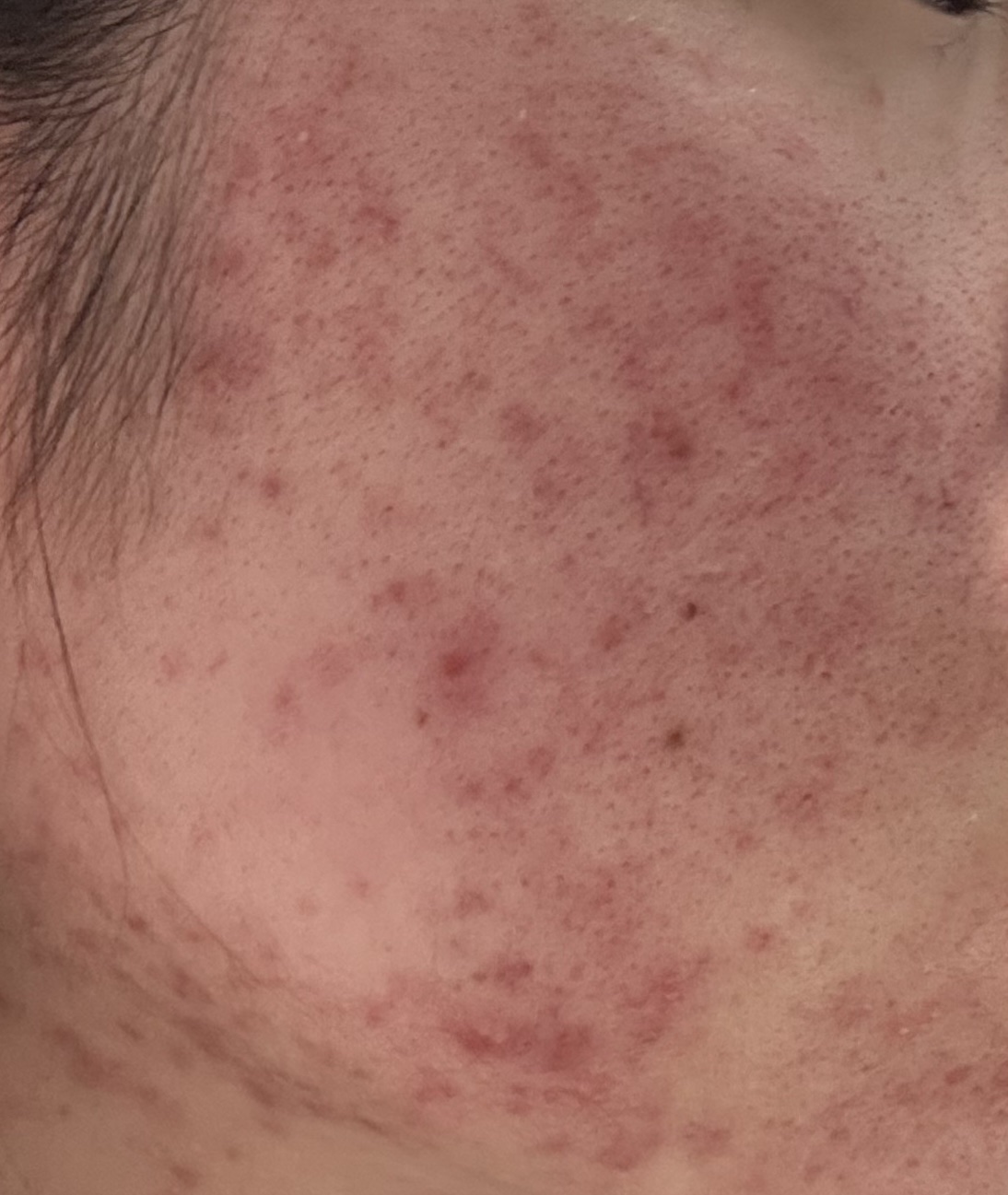 マジックカタツムリクリーム/ブラン/フェイスクリームを使ったクチコミ（2枚目）