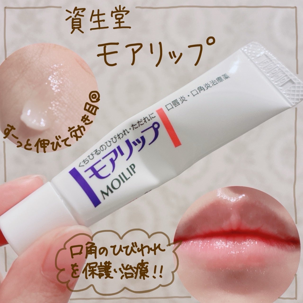 モアリップ N (医薬品)/資生堂薬品/その他を使ったクチコミ(1枚目)