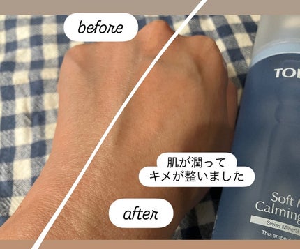 ソフトモイスチャーカーミングアンプル/TODAY With/美容液を使ったクチコミ(4枚目)