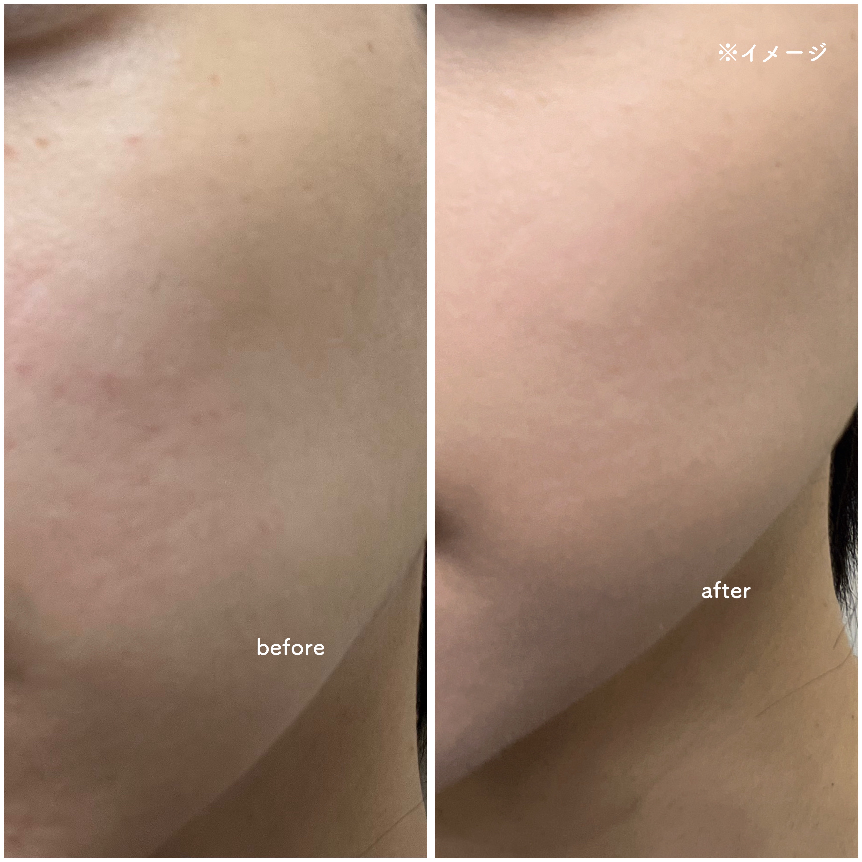 ドラマティックパウダリー EX/マキアージュ/パウダーファンデーションを使ったクチコミ（3枚目）