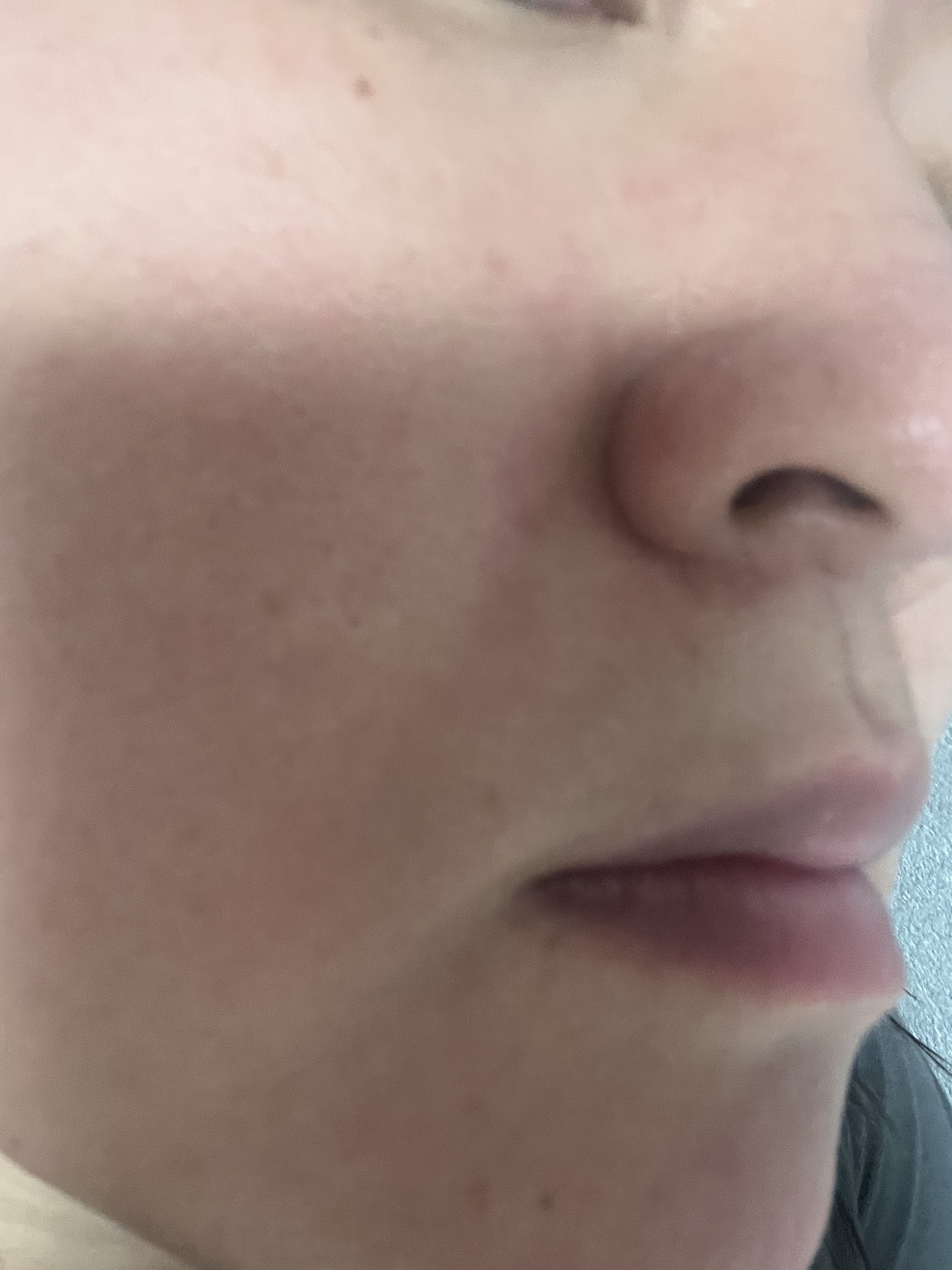 オーズナリージェットブルーセラム/オーズナリー/美容液を使ったクチコミ（2枚目）