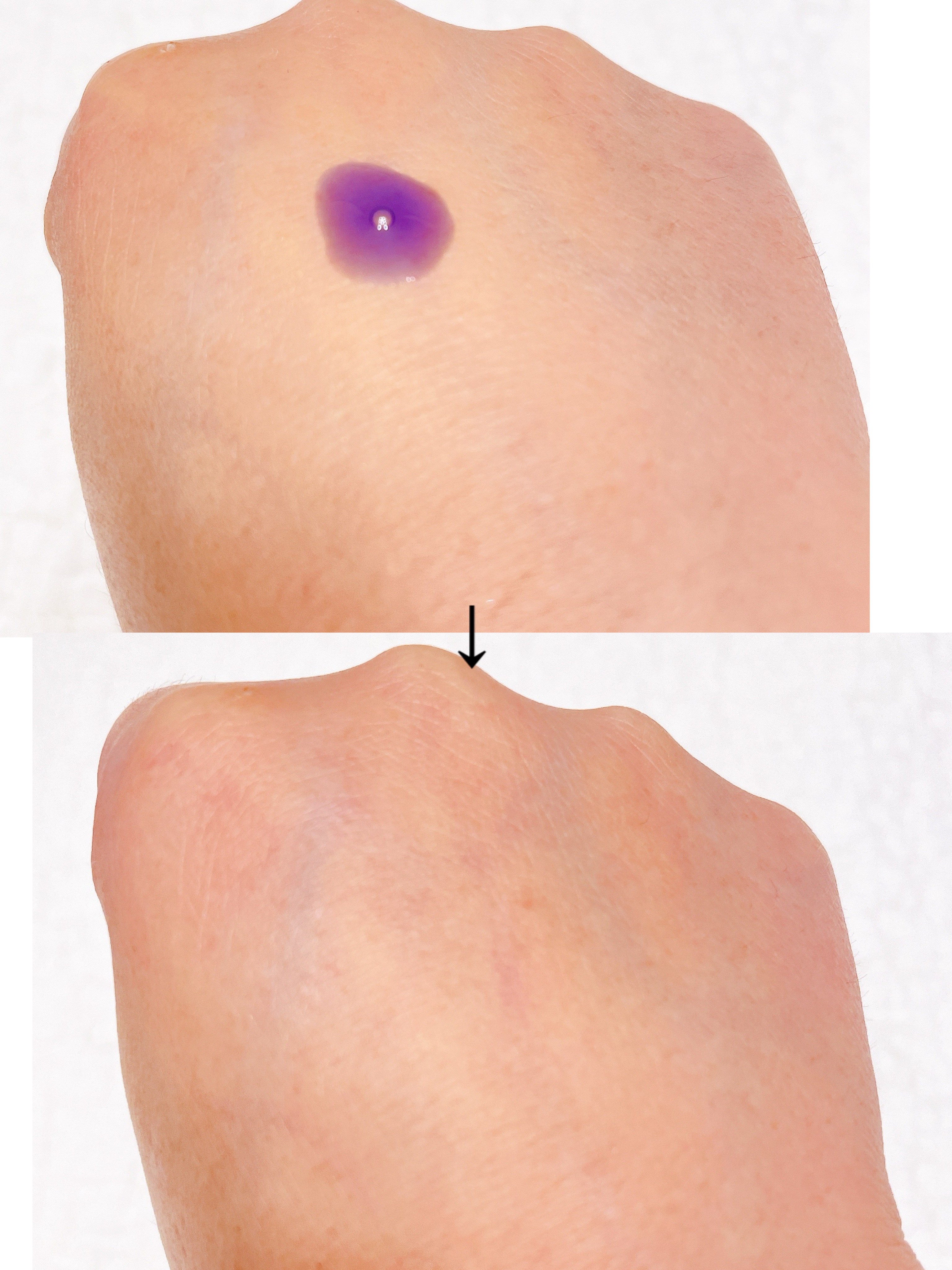 アズレンPDRNアンプル/Glow.M/美容液を使ったクチコミ（3枚目）