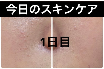 ザ・タイムR アクア/IPSA/化粧水を使ったクチコミ(1枚目)