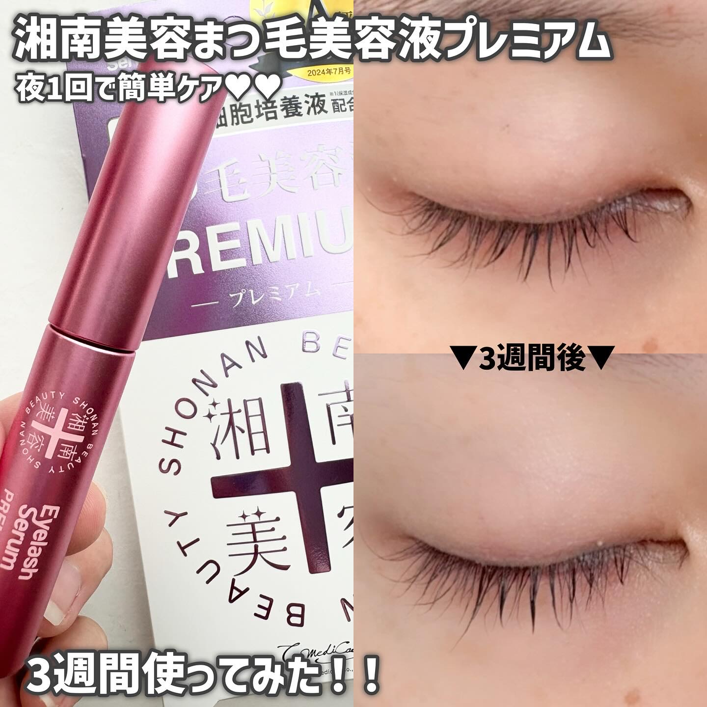 湘南美容まつ毛美容液PREMIUM/湘南美容/まつげ美容液を使ったクチコミ（1枚目）