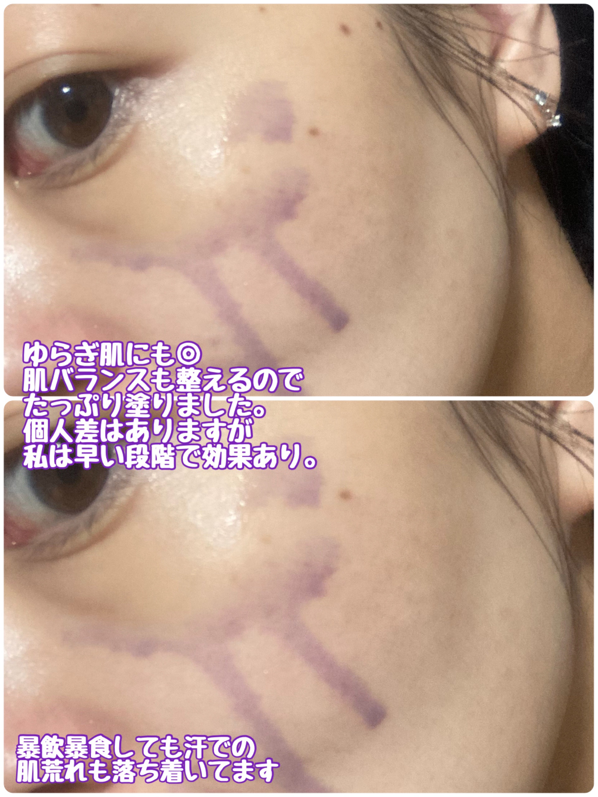 アズレンPDRNアンプル/Glow.M/美容液を使ったクチコミ（3枚目）