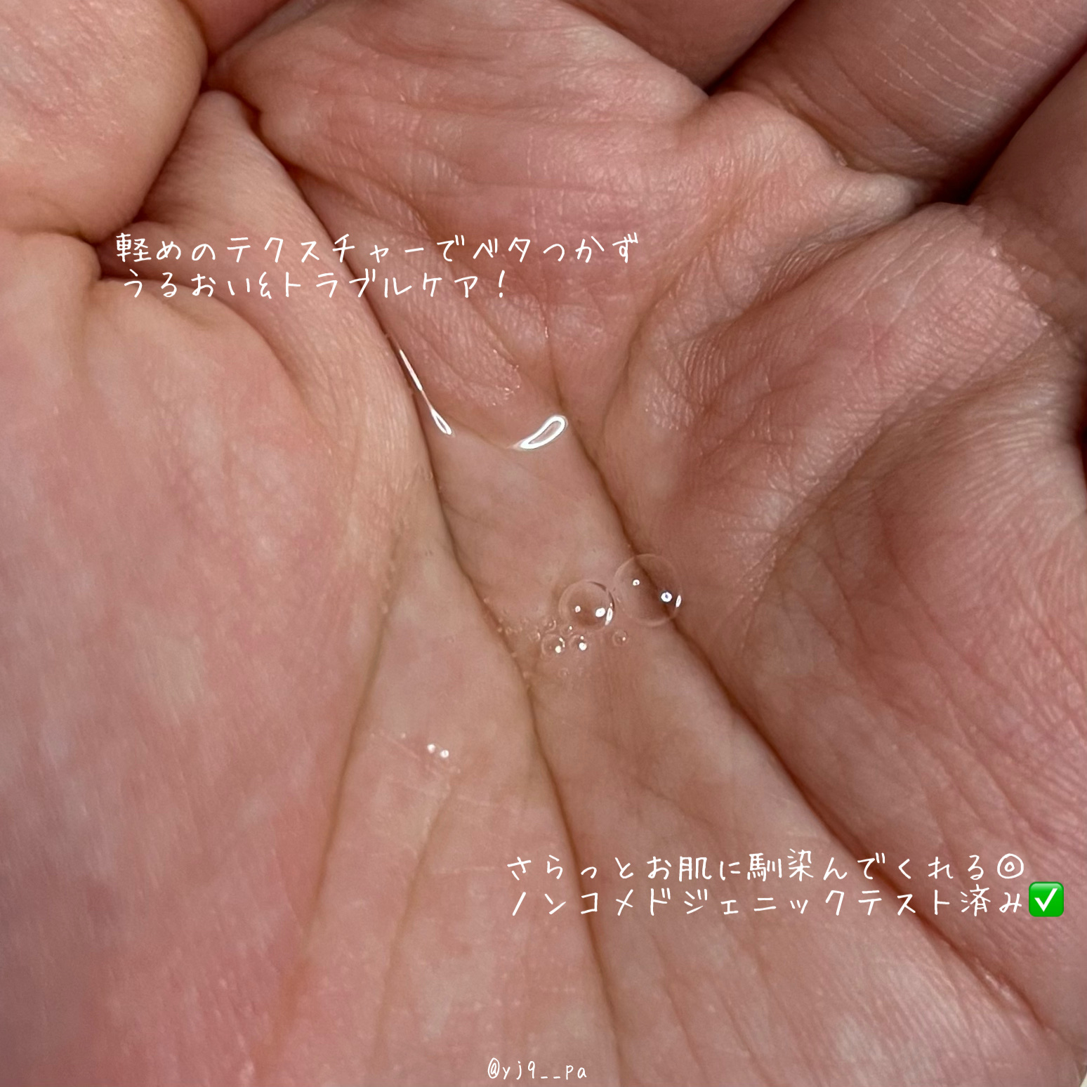 ノスカナイン トラブル セラム/FATION/美容液を使ったクチコミ（3枚目）