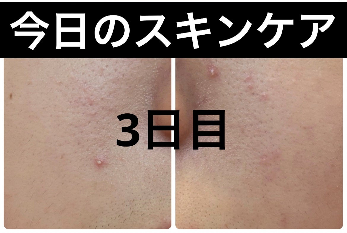 ザ・タイムR アクア/IPSA/化粧水を使ったクチコミ(1枚目)