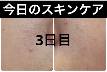 ザ・タイムR アクア/IPSA/化粧水を使ったクチコミ(1枚目)