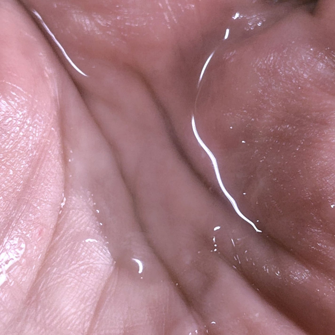 モイストバランス ローション/ACSEINE/化粧水を使ったクチコミ(3枚目)