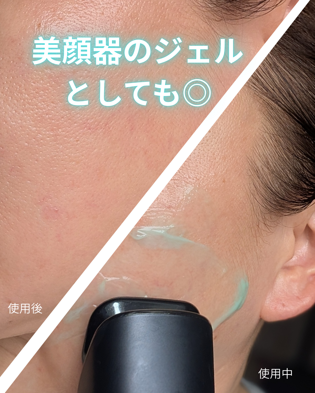 PDRN カプセルクリーム 100/VT/フェイスクリームを使ったクチコミ(2枚目)