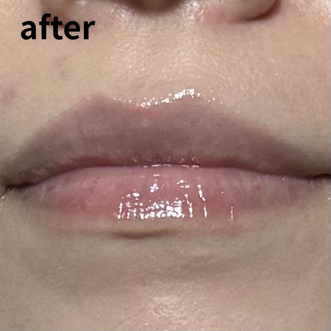 メンソレータム リップフォンデュ/メンソレータム/リッププランパーを使ったクチコミ(4枚目)