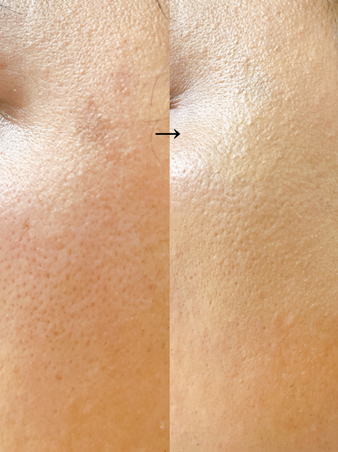 オブジェ ナチュラルカバーファンデーション SPF50+ PA++++/オブジェ/その他ファンデーションを使ったクチコミ(5枚目)