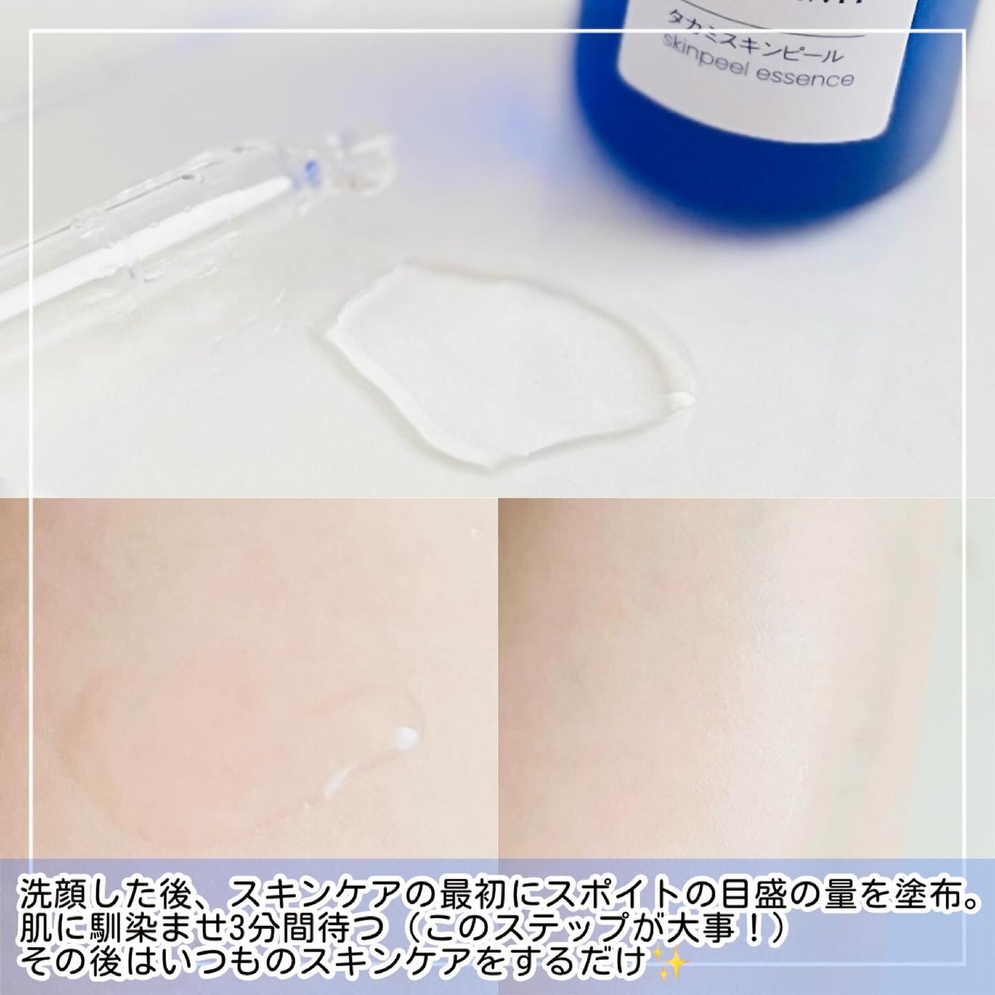 タカミスキンピール/タカミ/ブースター・導入液を使ったクチコミ(2枚目)