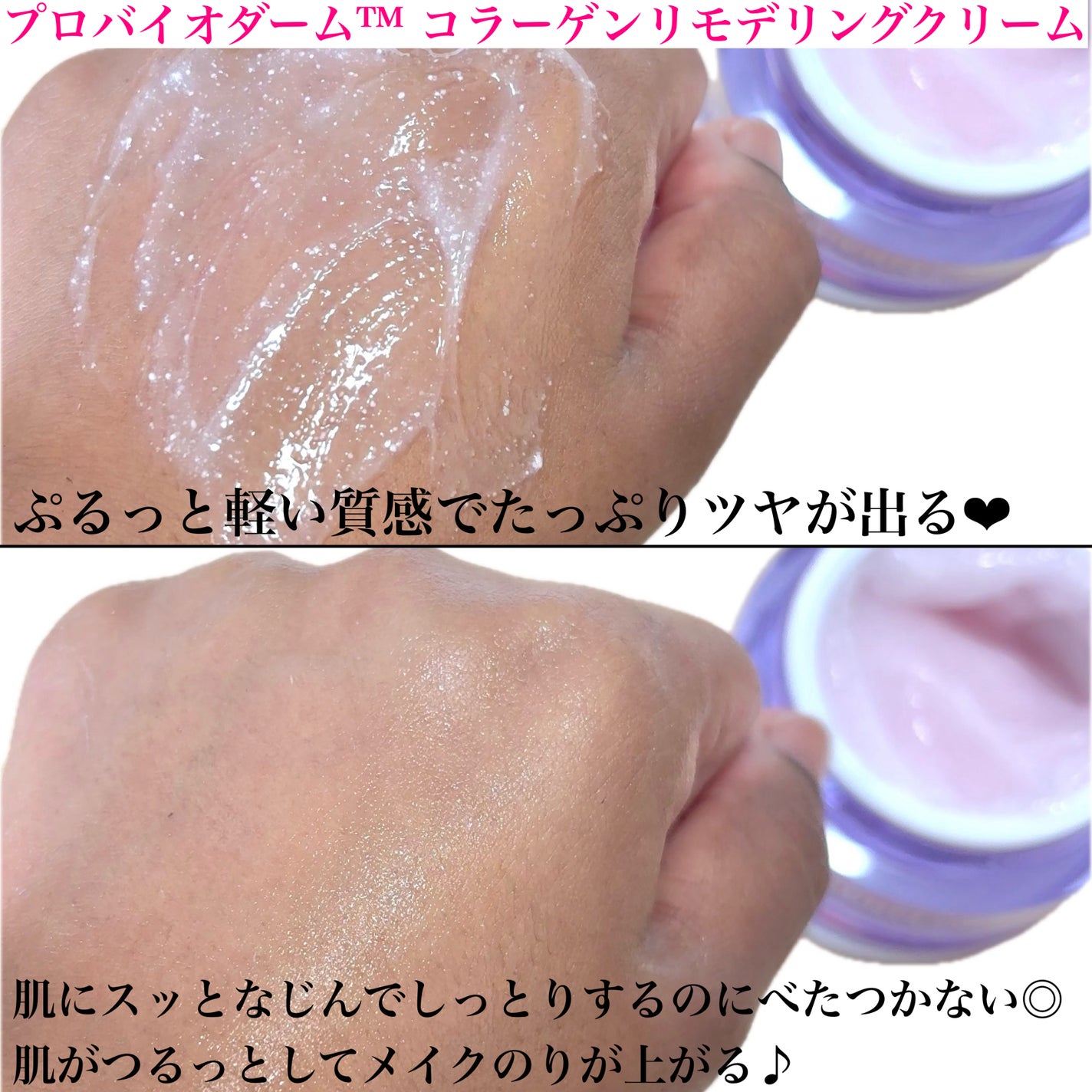 バイオヒールボ プロバイオダーム 3Dリフティングクリーム/BIOHEAL BOH/フェイスクリームを使ったクチコミ(7枚目)