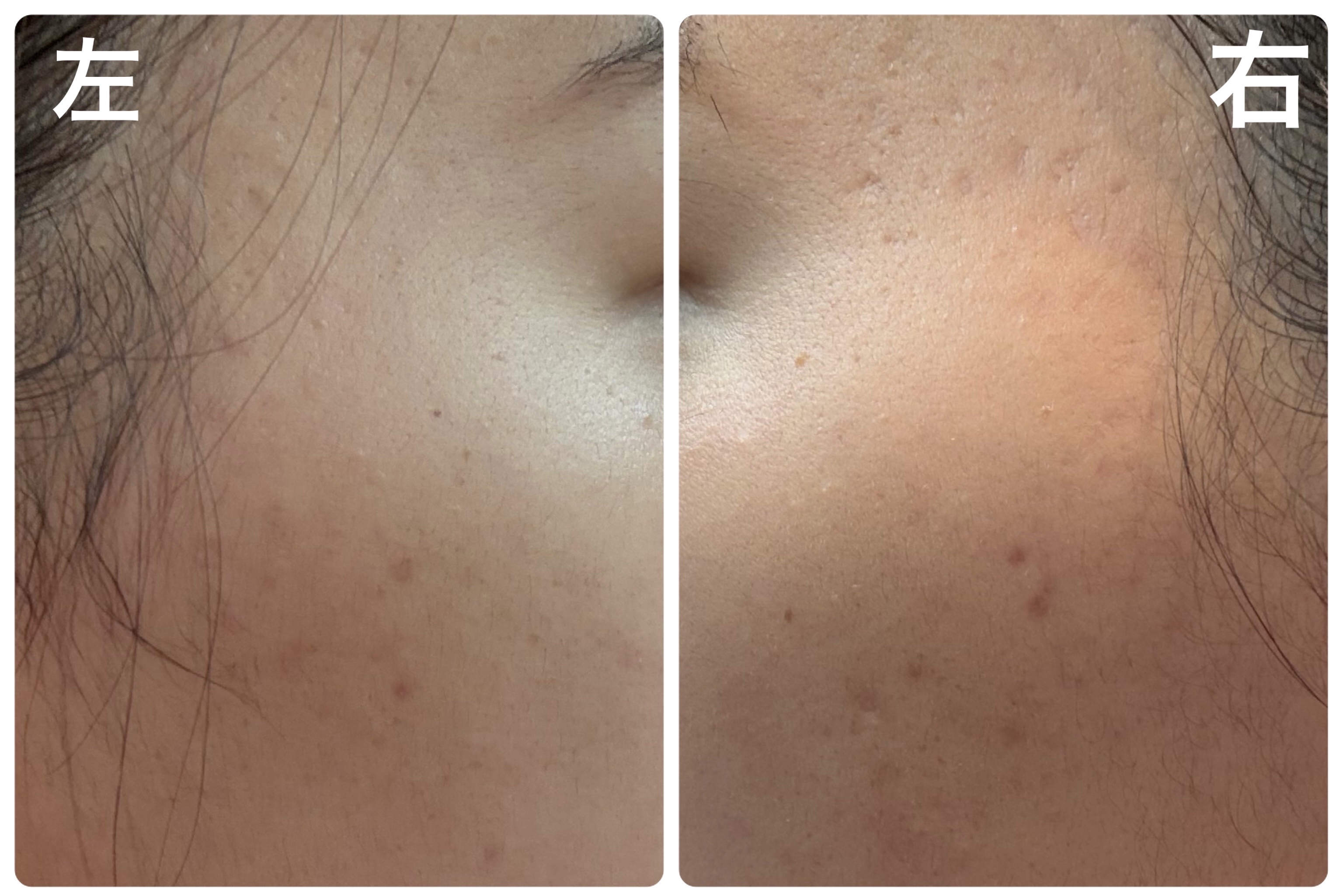 Hadaral 十味敗毒湯錠(医薬品)/大峰堂/その他を使ったクチコミ（2枚目）