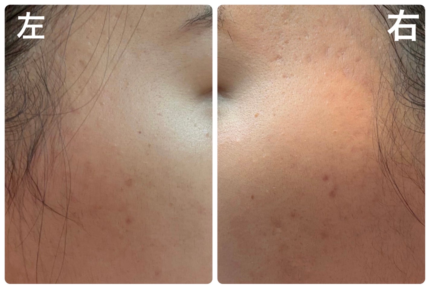 ザ・タイムR アクア/IPSA/化粧水を使ったクチコミ(2枚目)