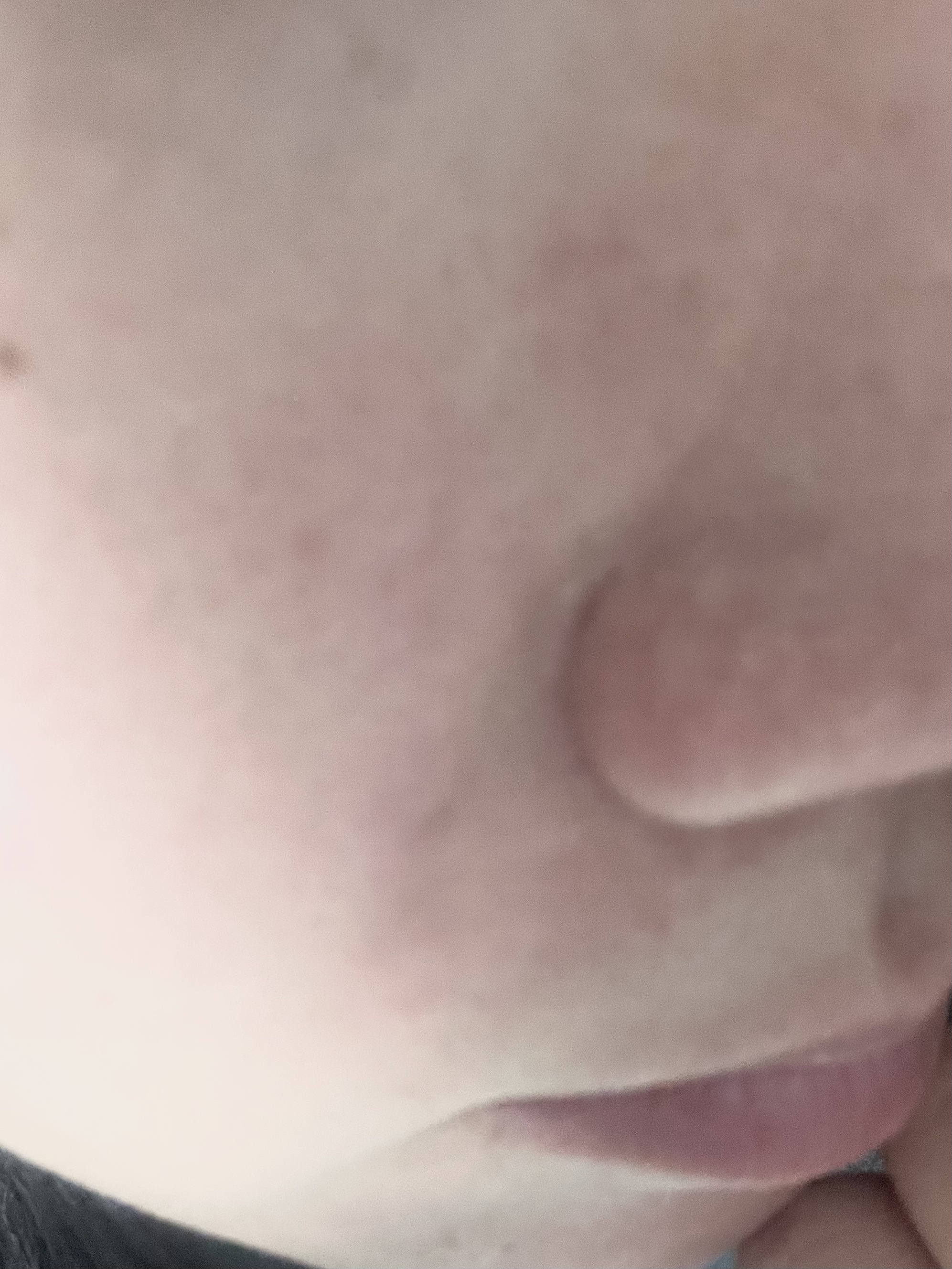 ビタ3セラム/オーズナリー/美容液を使ったクチコミ（2枚目）