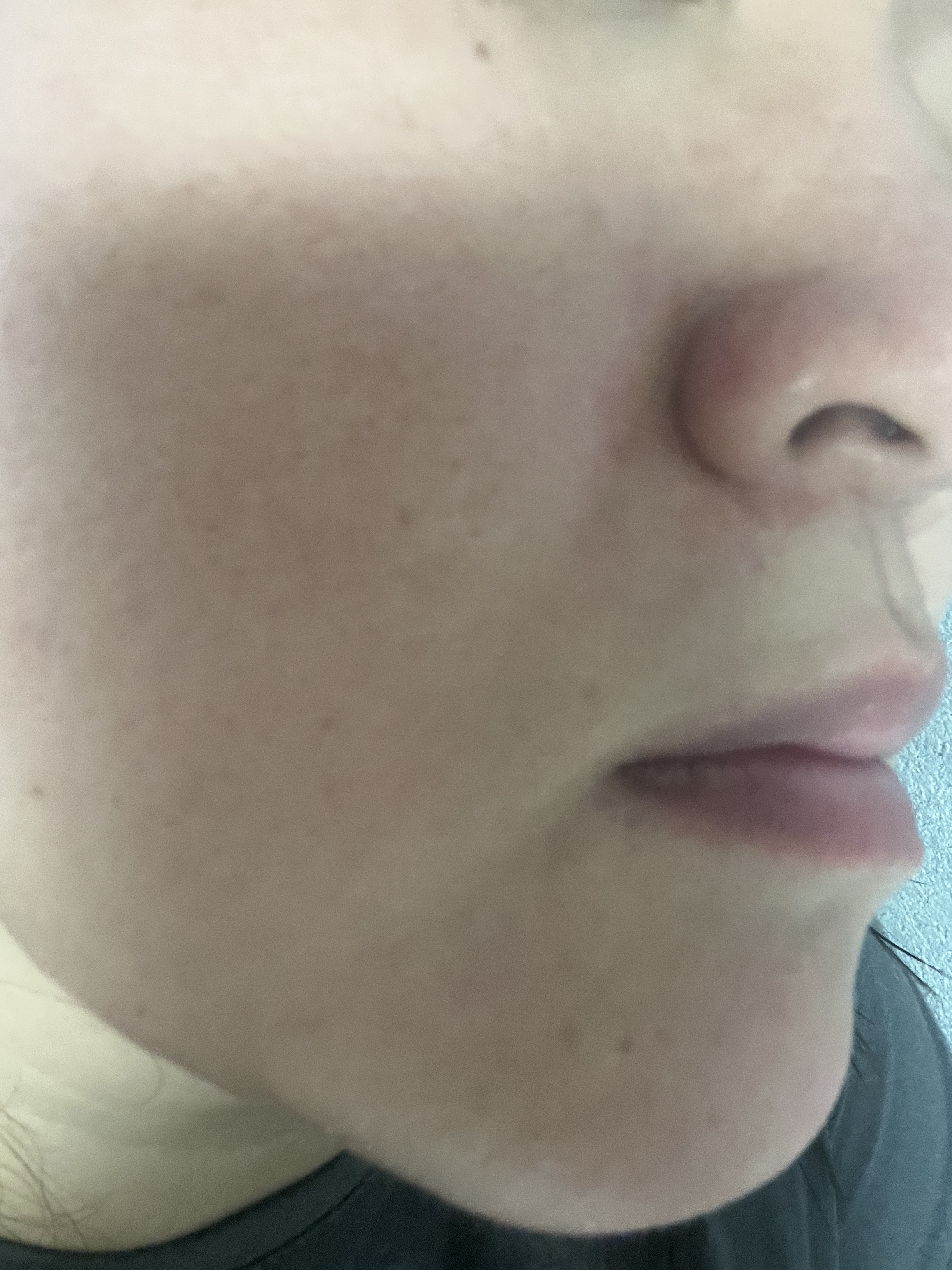 オーズナリージェットブルーセラム/オーズナリー/美容液を使ったクチコミ（3枚目）