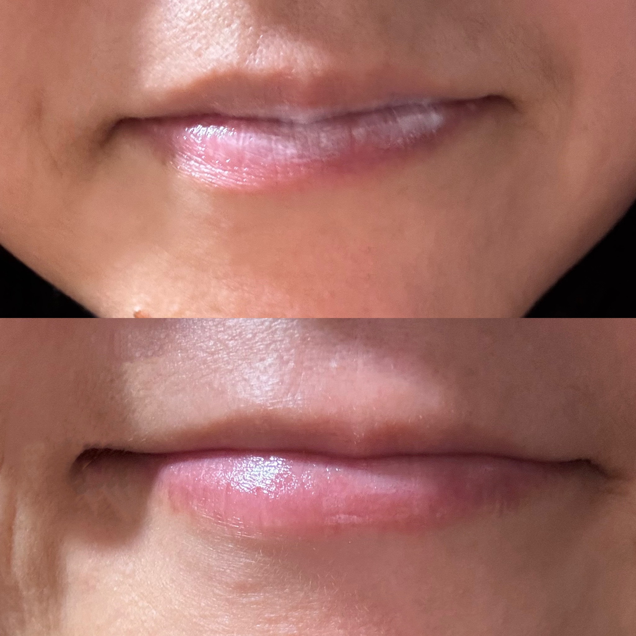 メディプラス リペアリップパック/メディプラス/リップケアを使ったクチコミ（2枚目）