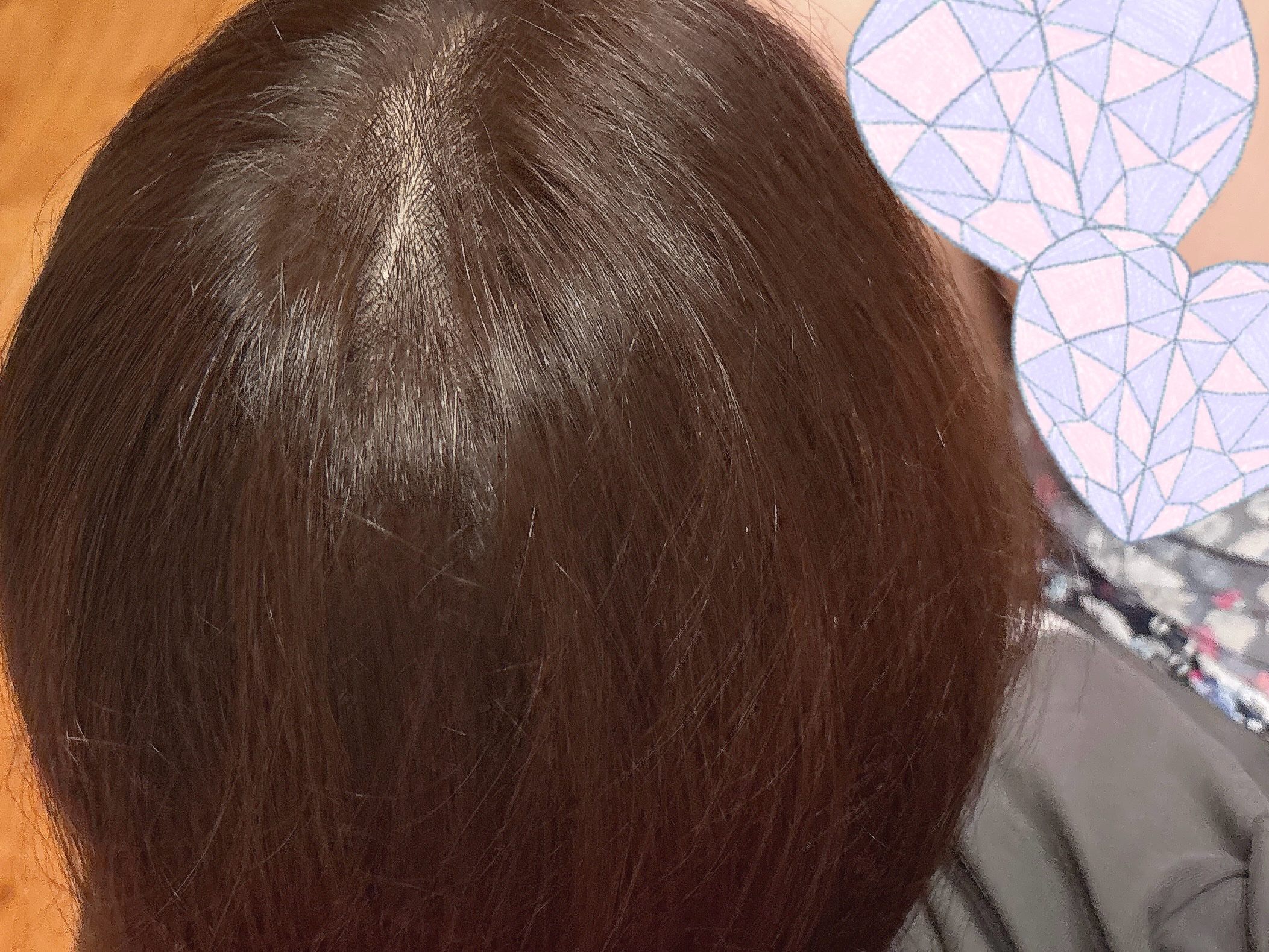 泡カラー/リーゼ/ヘアカラーを使ったクチコミ（2枚目）