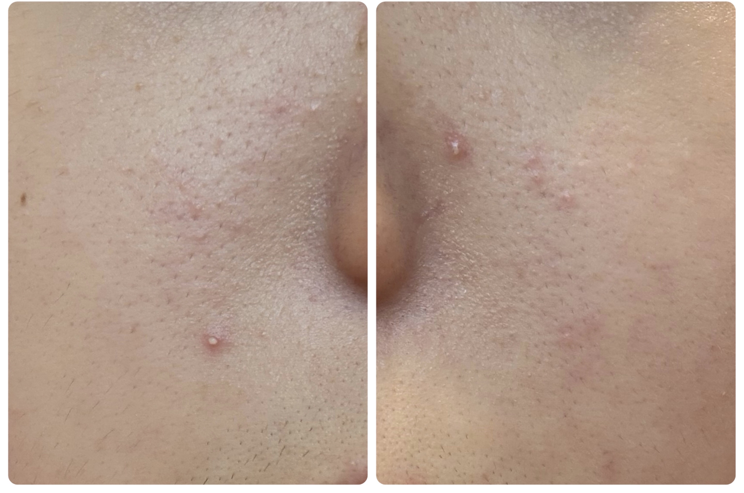 Hadaral 十味敗毒湯錠(医薬品)/大峰堂/その他を使ったクチコミ（3枚目）