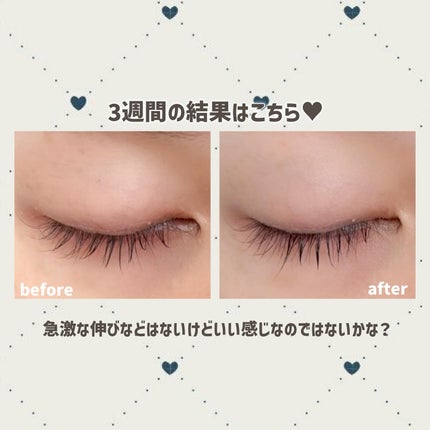 湘南美容まつ毛美容液PREMIUM/湘南美容/まつげ美容液を使ったクチコミ(3枚目)