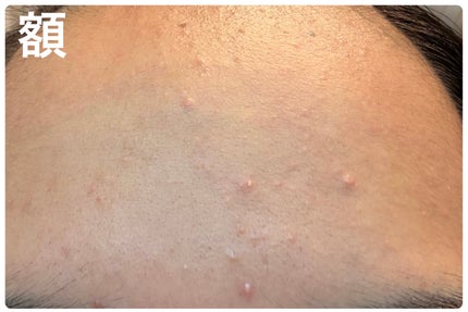 ザ・タイムR アクア/IPSA/化粧水を使ったクチコミ(4枚目)