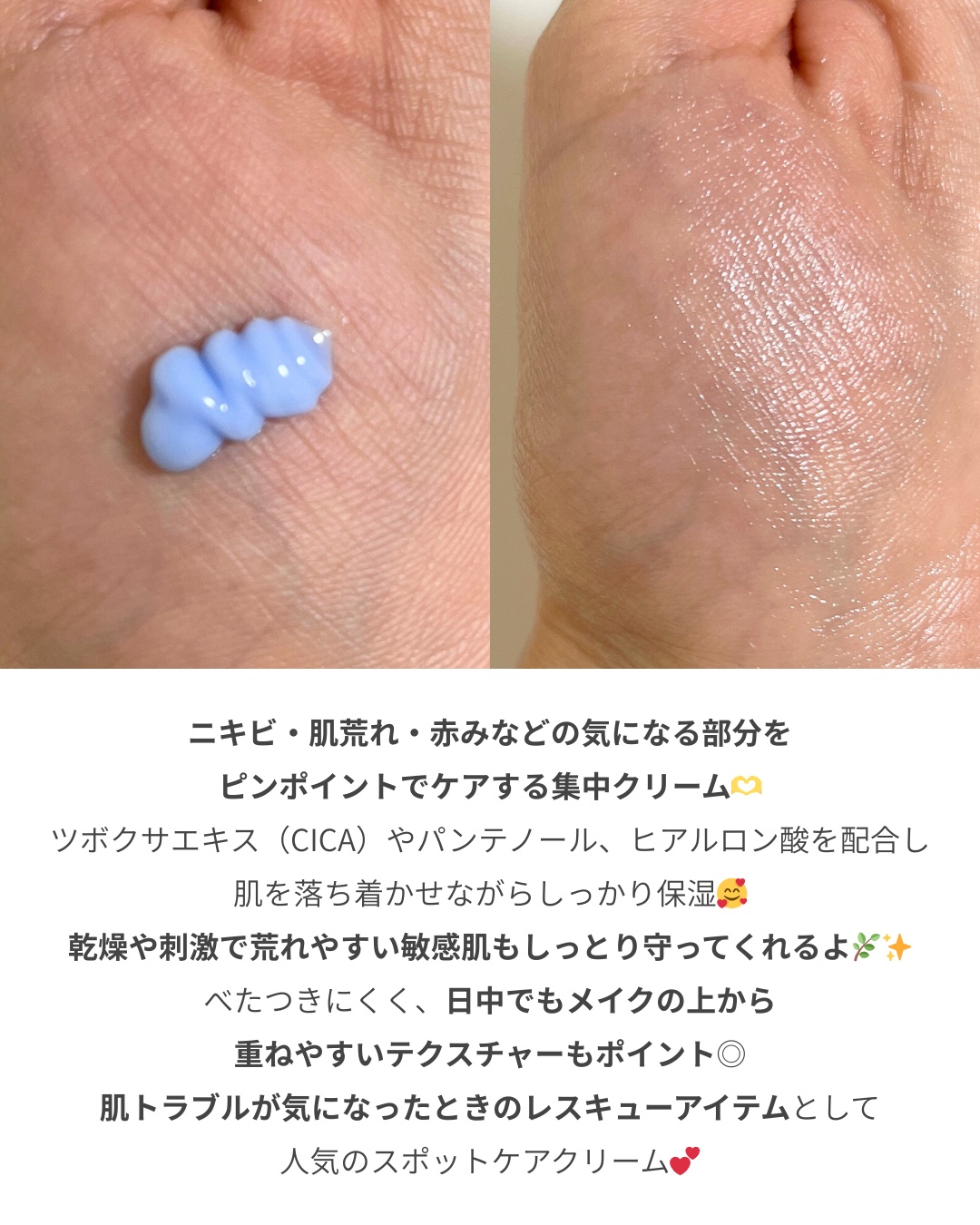 PHセンシティブスポットクリーム/SAM'U/フェイスクリームを使ったクチコミ（2枚目）