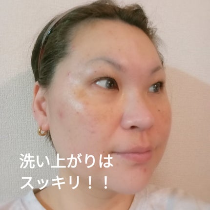 ブラックジェルクレンジング/.akaran/クレンジングジェルを使ったクチコミ(4枚目)