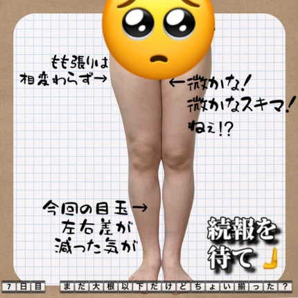 うら@フォロバ100 on LIPS 「引き続きど正面から現実受け止めるべき30代、経過報告です。投稿..」(2枚目)