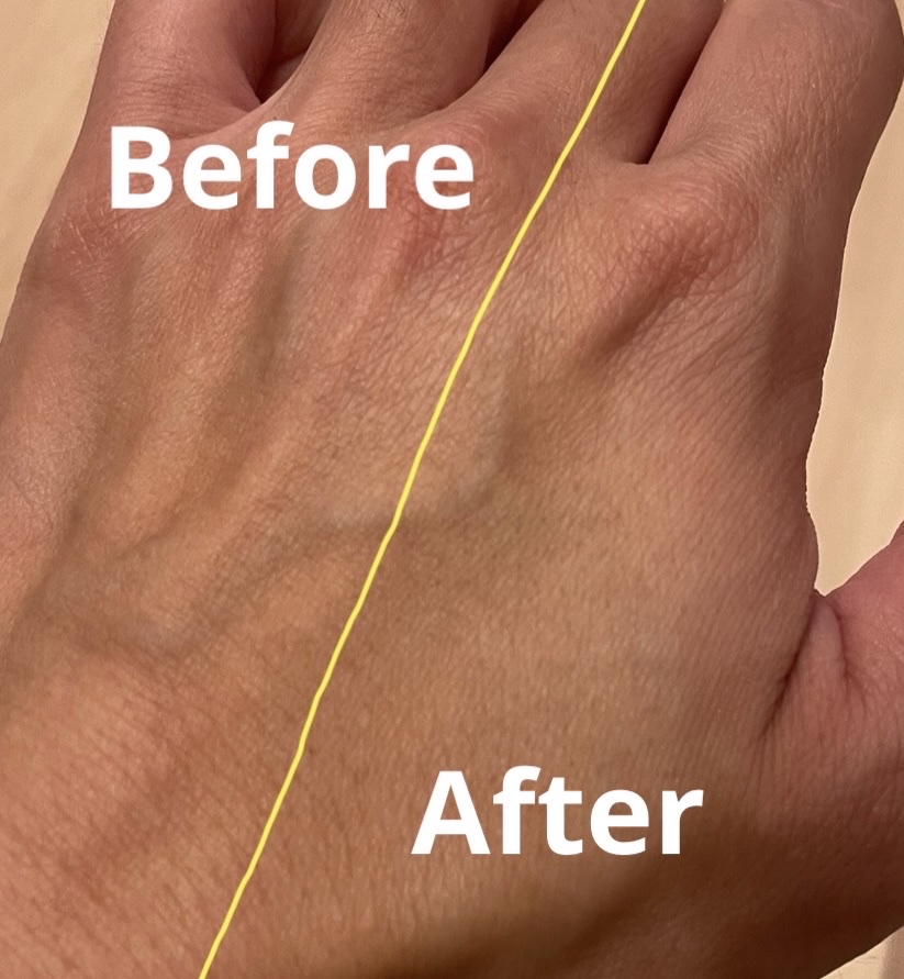 ティーツリーハーブピーリングパック/WellDerma/洗い流すパック・マスクを使ったクチコミ（3枚目）