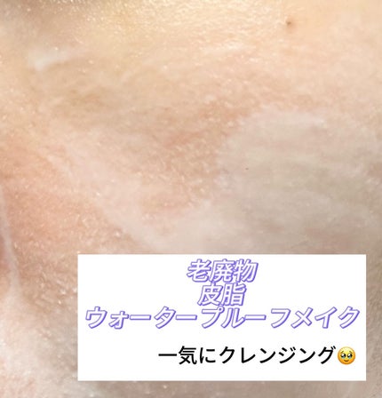 PDRN+リードルS 100/VT/美容液を使ったクチコミ(4枚目)