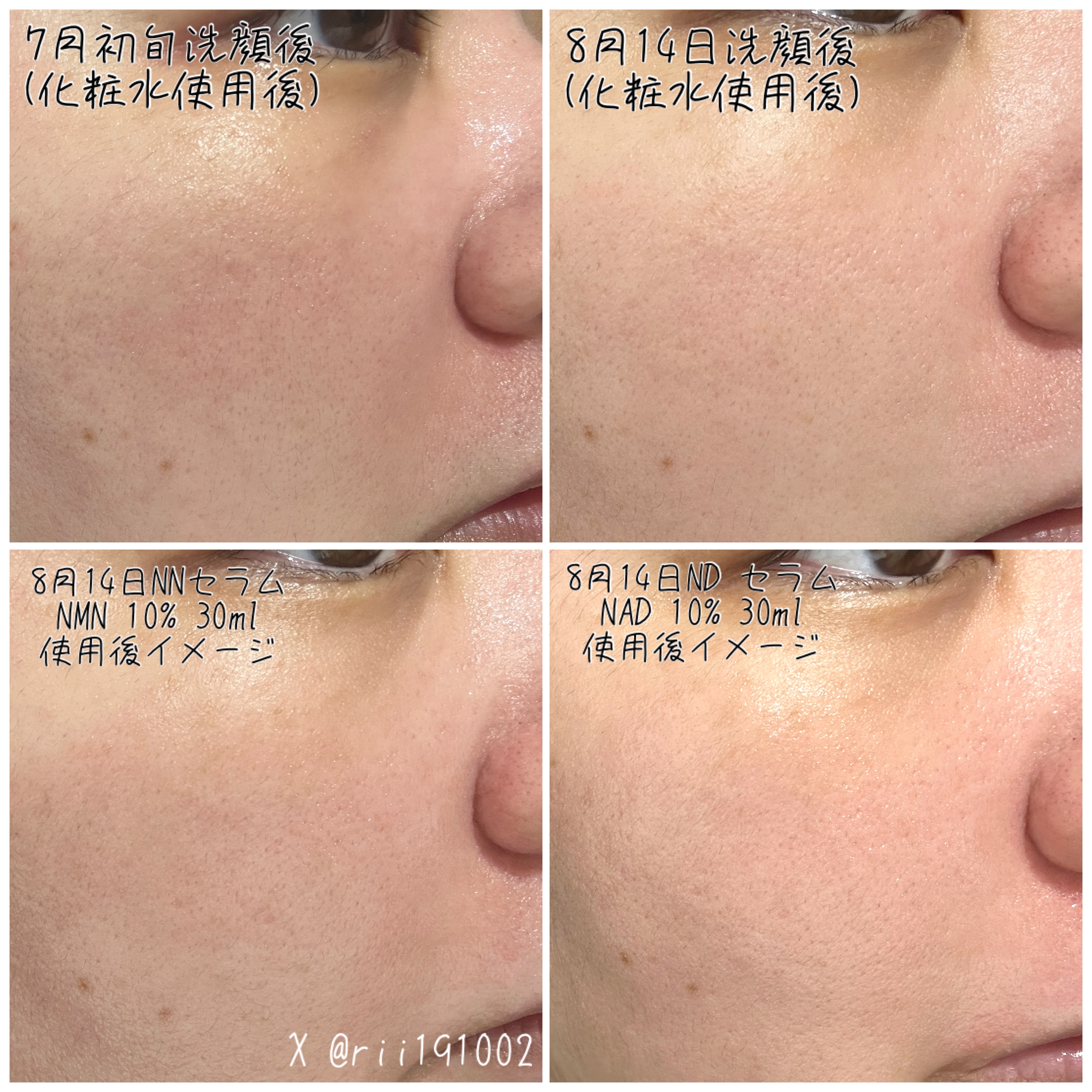 NNセラム NMN 10%/コスデバハ/美容液を使ったクチコミ（3枚目）