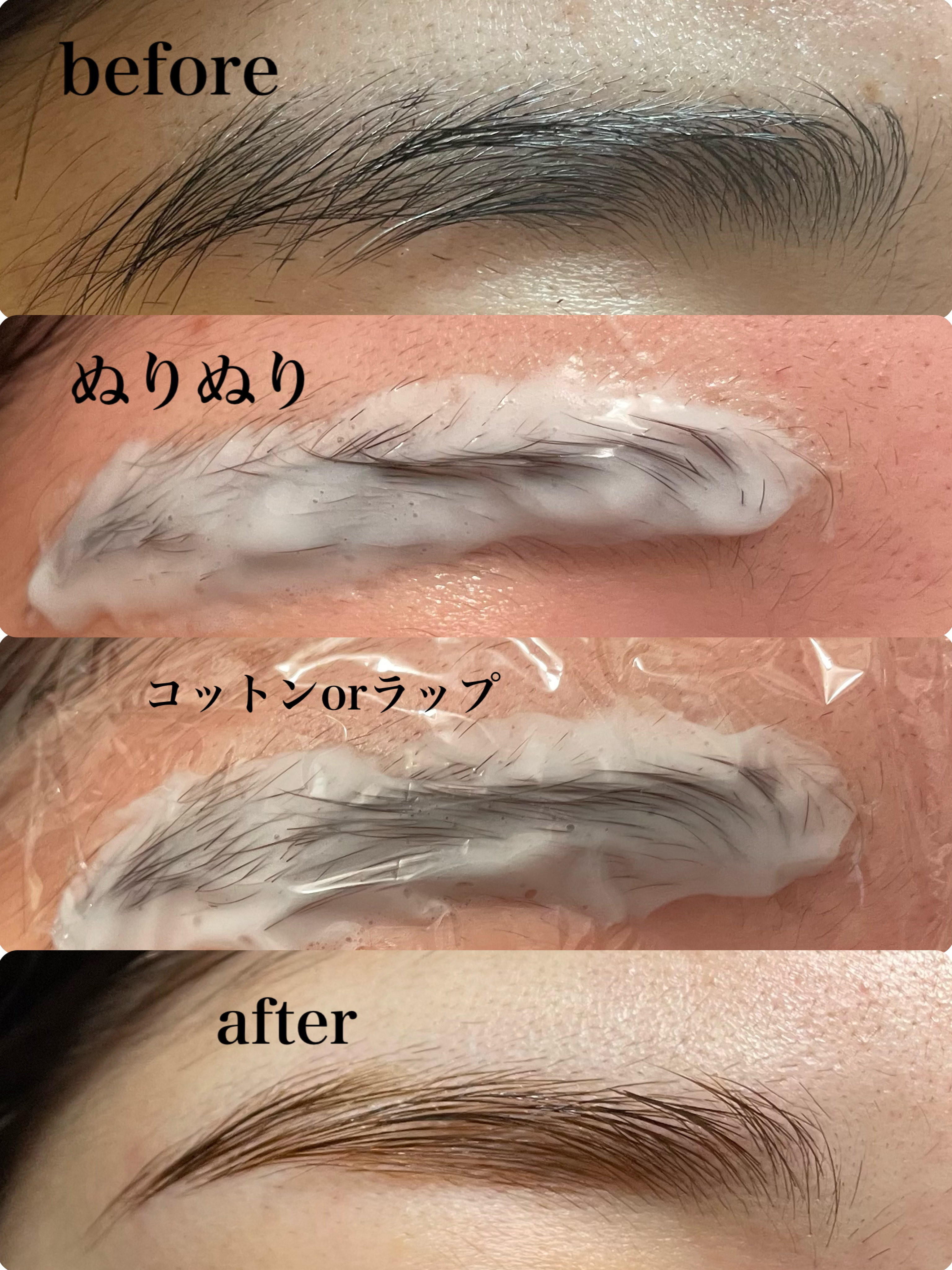 脱色クリーム スピーディー/エピラット/ムダ毛ケアを使ったクチコミ（2枚目）