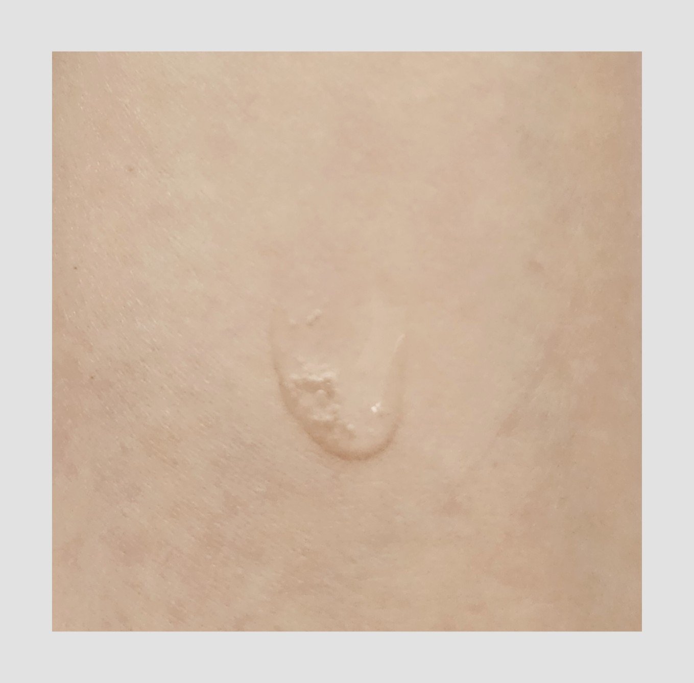 ソフトモイスチャーカーミングアンプル/TODAY With/美容液を使ったクチコミ（3枚目）