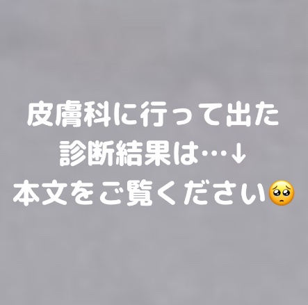 薬用エマルジョン/IHADA/乳液を使ったクチコミ（3枚目）