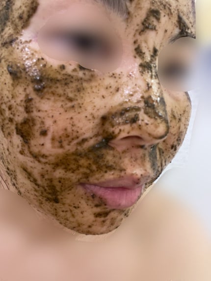 ティーツリーハーブピーリングパック/WellDerma/洗い流すパック・マスクを使ったクチコミ(1枚目)