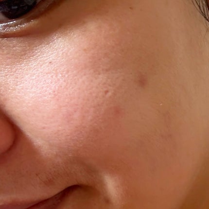 ブレミッシュバブルマッドマスク/PAPA RECIPE/スクラブ・ゴマージュを使ったクチコミ(7枚目)