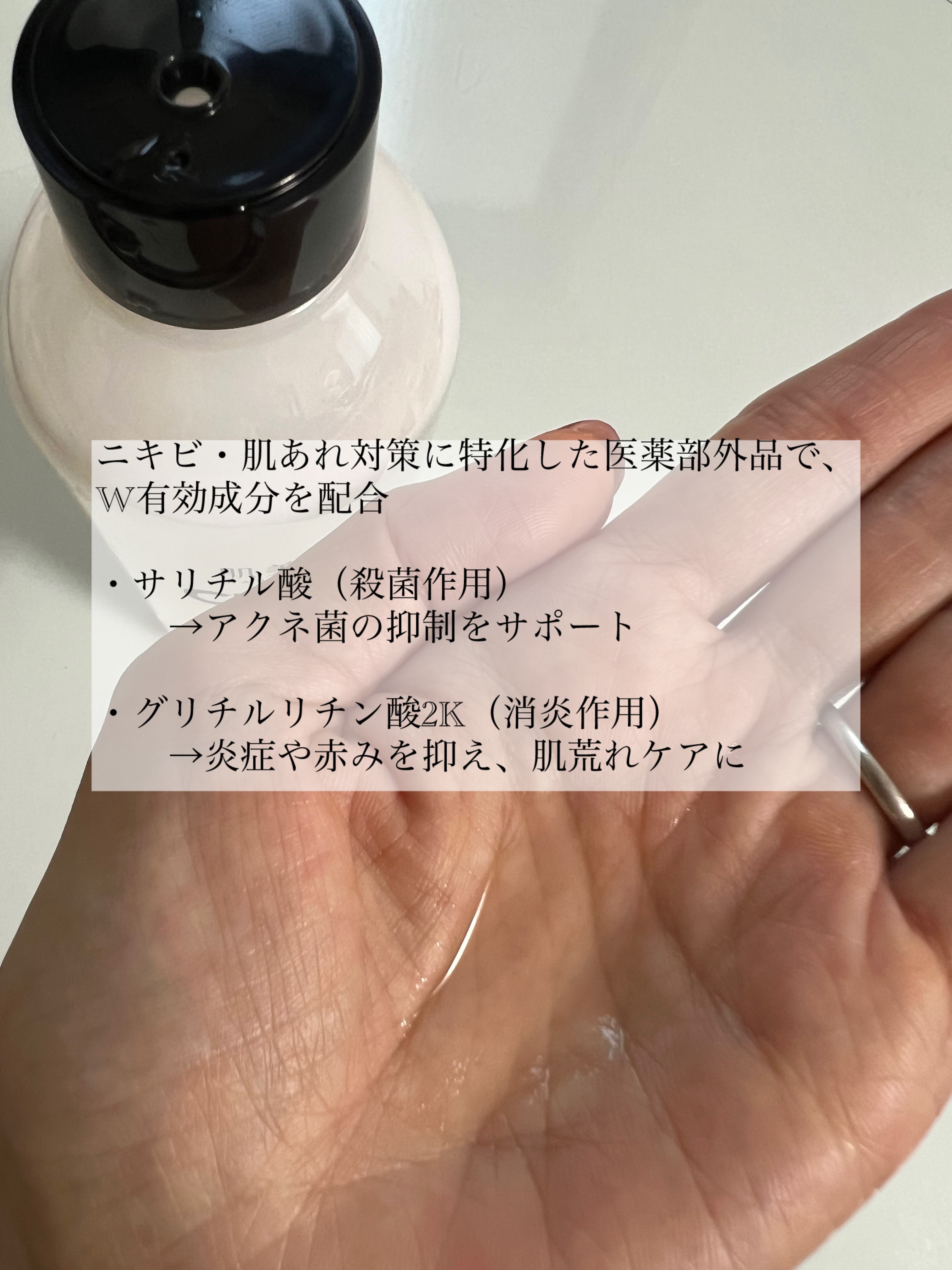 肌美精 CHOI薬用化粧水 ニキビケア[医薬部外品]/肌美精/化粧水を使ったクチコミ（2枚目）