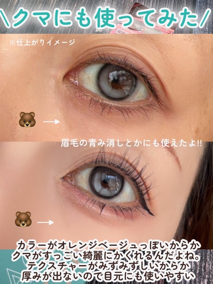 薬用アクネコンシーラー/ONEPEN/スティックコンシーラーを使ったクチコミ(7枚目)