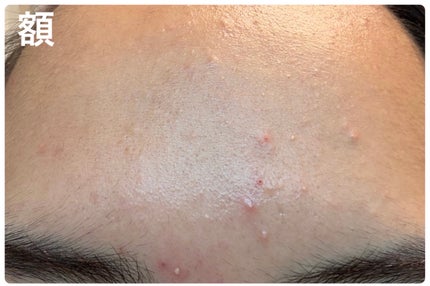 ザ・タイムR アクア 100ml/IPSA/化粧水の画像