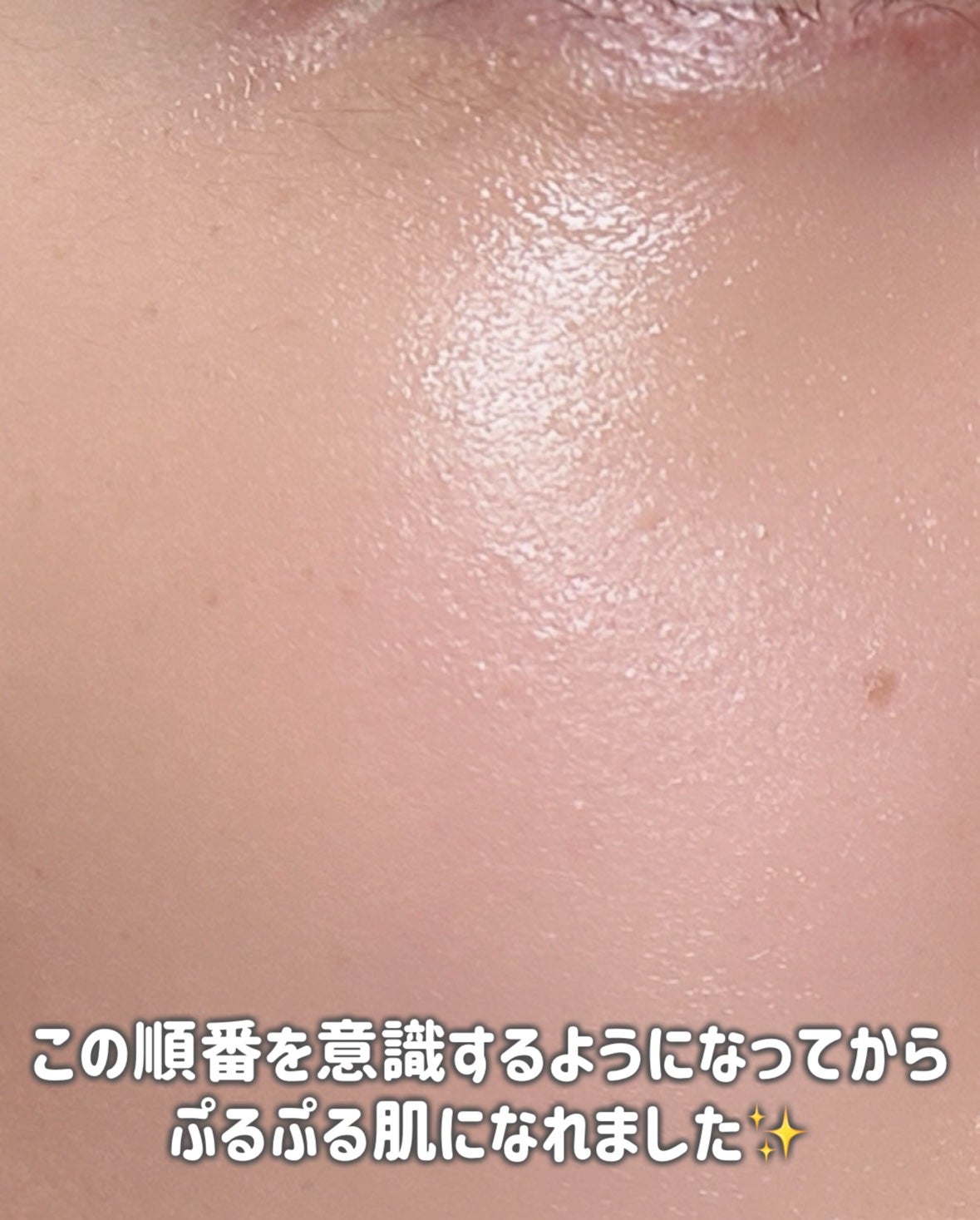 ハトムギ化粧水(ナチュリエ スキンコンディショナー R )/ナチュリエ/化粧水を使ったクチコミ(7枚目)