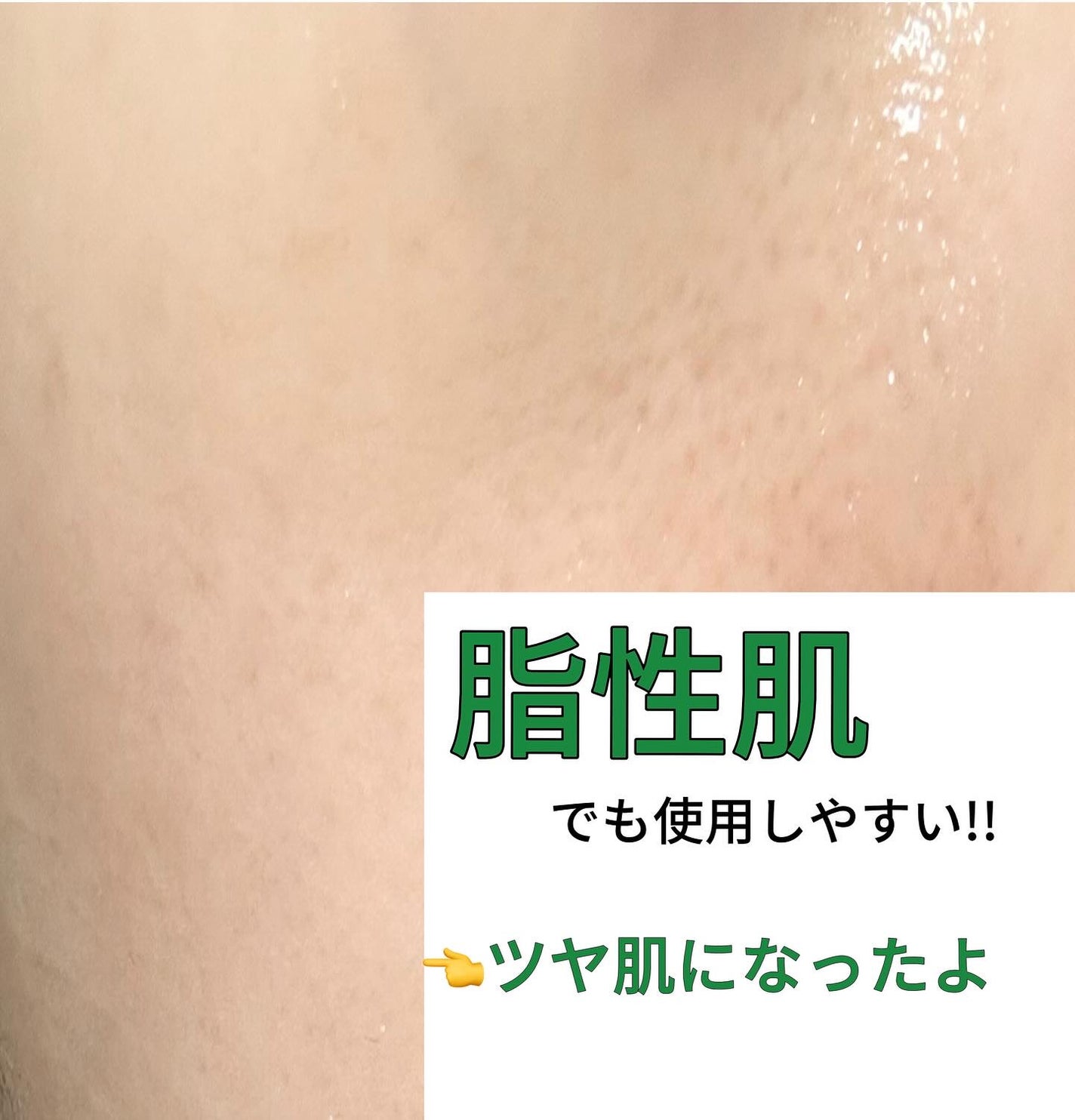 PDRN+リードルS 100/VT/美容液を使ったクチコミ(10枚目)