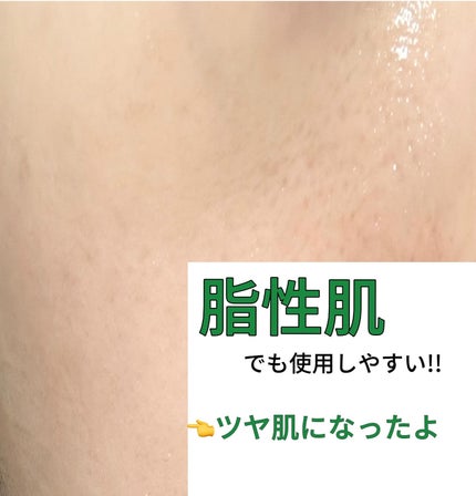 PDRN+リードルS 100/VT/美容液を使ったクチコミ(10枚目)