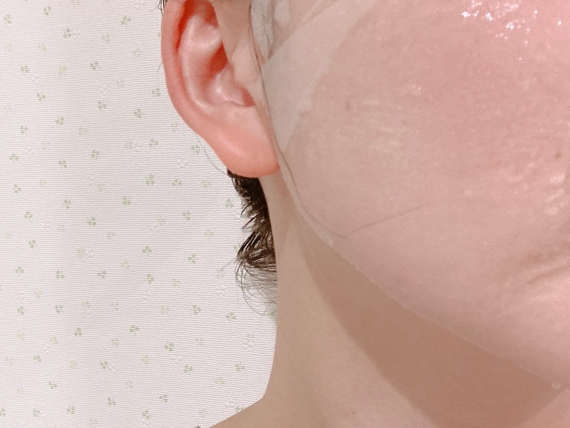 メディリフト ニードルリフトシートマスク/YA-MAN TOKYO JAPAN/シートマスク・パックを使ったクチコミ（2枚目）