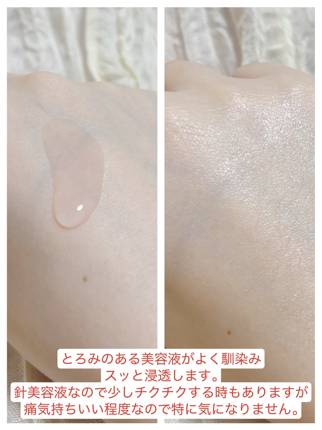 ピンクトーニング™︎ディープインショットアンプル/CNP Laboratory/美容液を使ったクチコミ(3枚目)