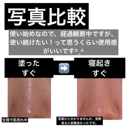 ãã€ãªããŒã«ã ãããã€ãªããŒã 3Dãªããã£ã³ã°ã¯ãªãŒã /BIOHEAL BOH/ãã§ã€ã¹ã¯ãªãŒã ã䜿ã£ãã¯ãã³ãïŒ7æç®ïŒ