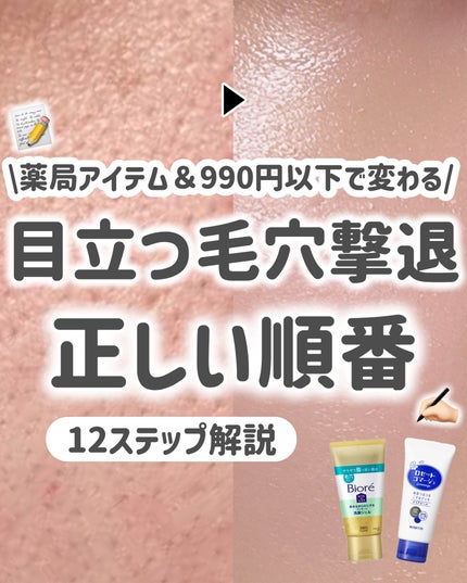 ハトムギ化粧水(ナチュリエ スキンコンディショナー R )/ナチュリエ/化粧水を使ったクチコミ(1枚目)