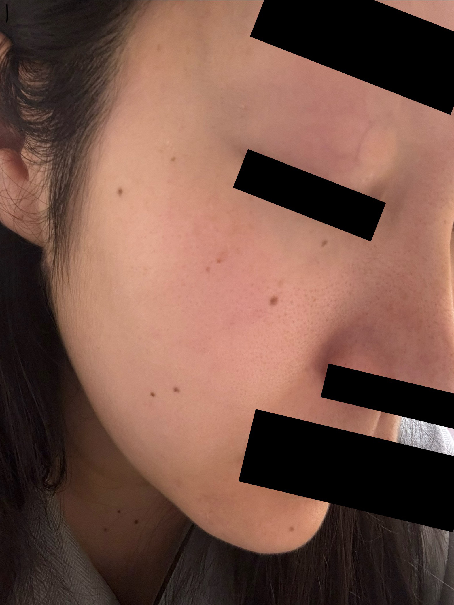 オバジX リフトローション/オバジ/化粧水を使ったクチコミ（2枚目）